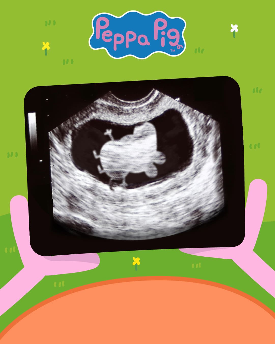 Peppa Pig ultrasound
