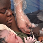 Third stage of labour