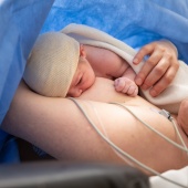 Breastfeeding after caesarean
