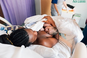 Breastfeeding after a caesarean birth