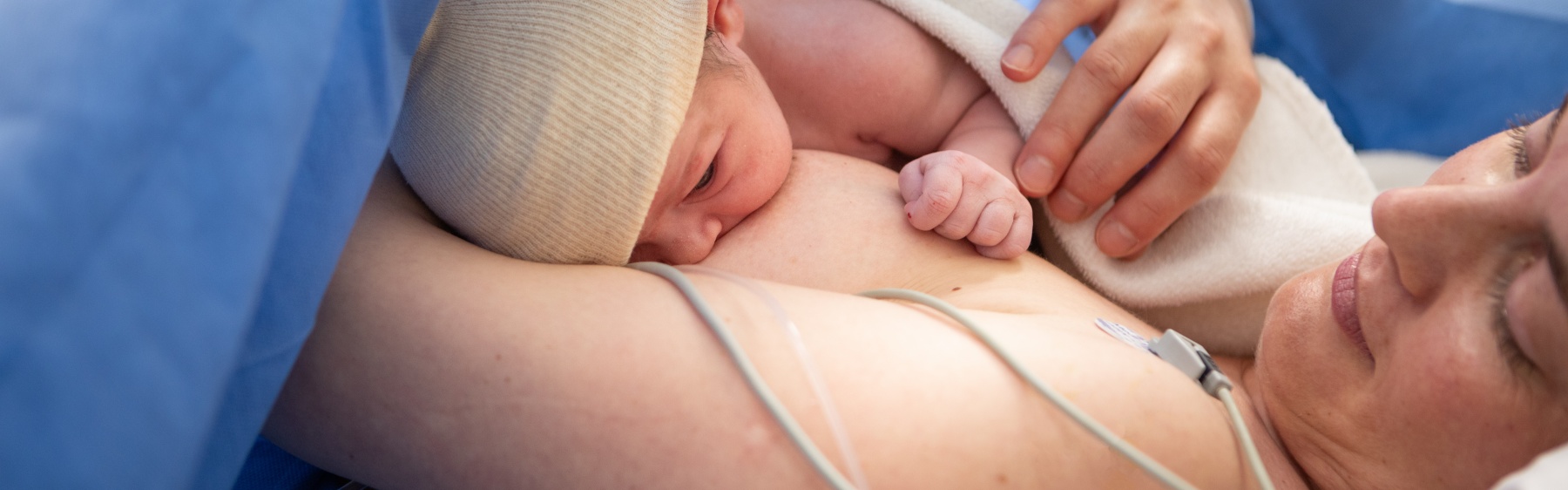 Breastfeeding after caesarean