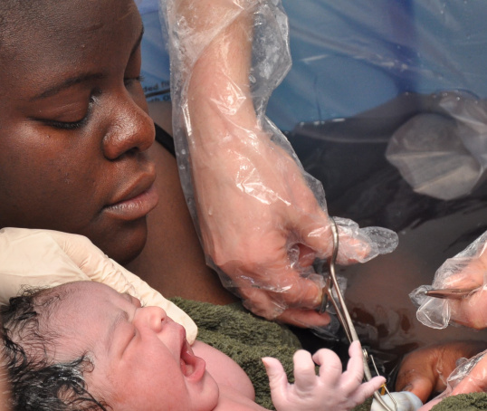 Umbilical cord cut after birth