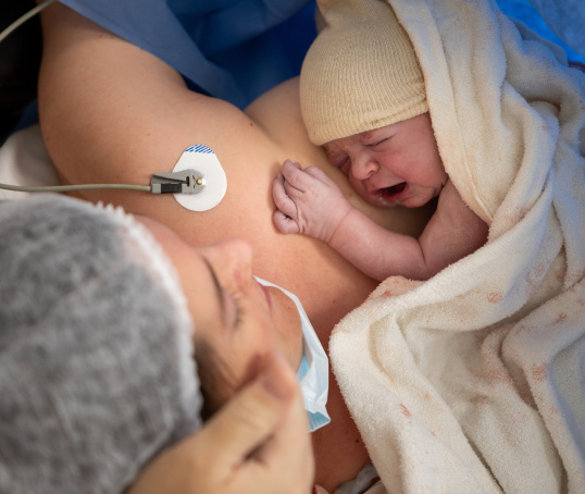Caesarean birth