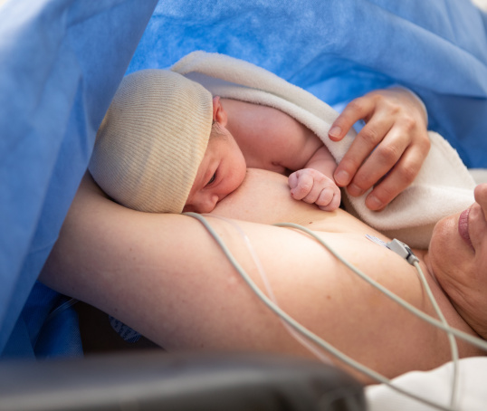 Breastfeeding after caesarean