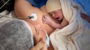 Caesarean birth