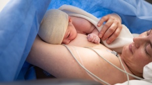 Breastfeeding after caesarean